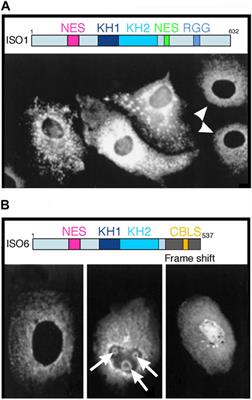 The fragile X proteins’ enigma: to be or not to be nucleolar